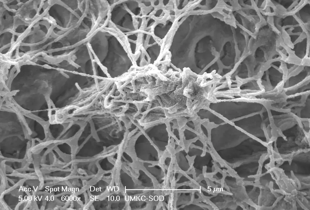 Rete Neurale Ossea: Il Connettoma Osteocitario