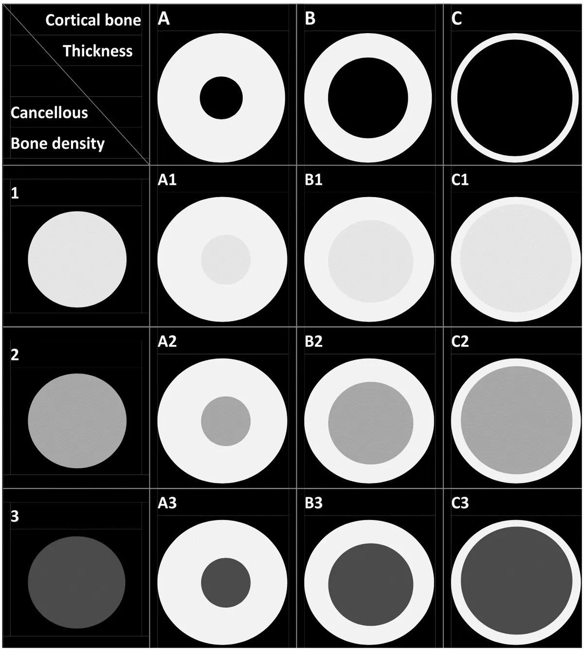 classificazione-osso-alveolare-wang-a1-c3