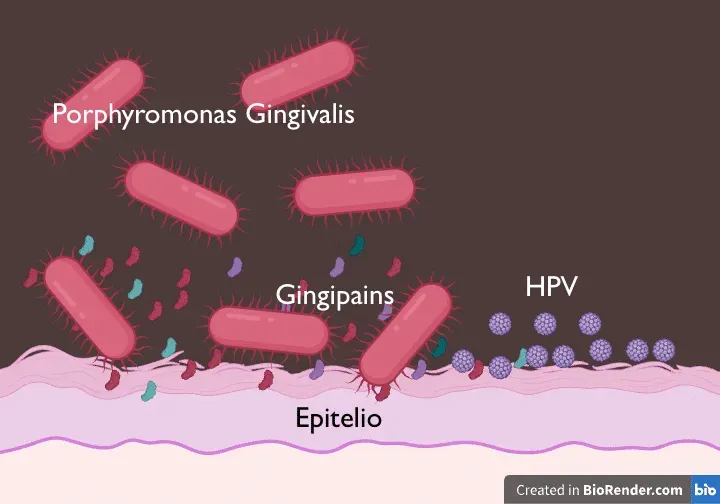 Rappresentazione grafica di batteri Porphyromonas gingivalis, gingipain e HPV che interagiscono con l