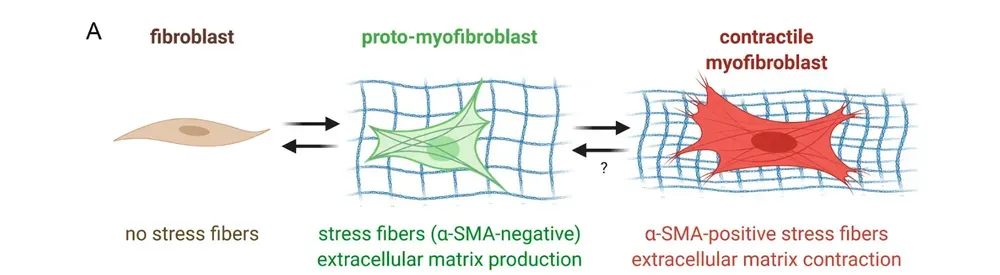 Diagramma illustrativo che mostra la trasformazione dei fibroblasti in miofibroblasti, evidenziando le caratteristiche cellulari e la produzione di matrice extracellulare.