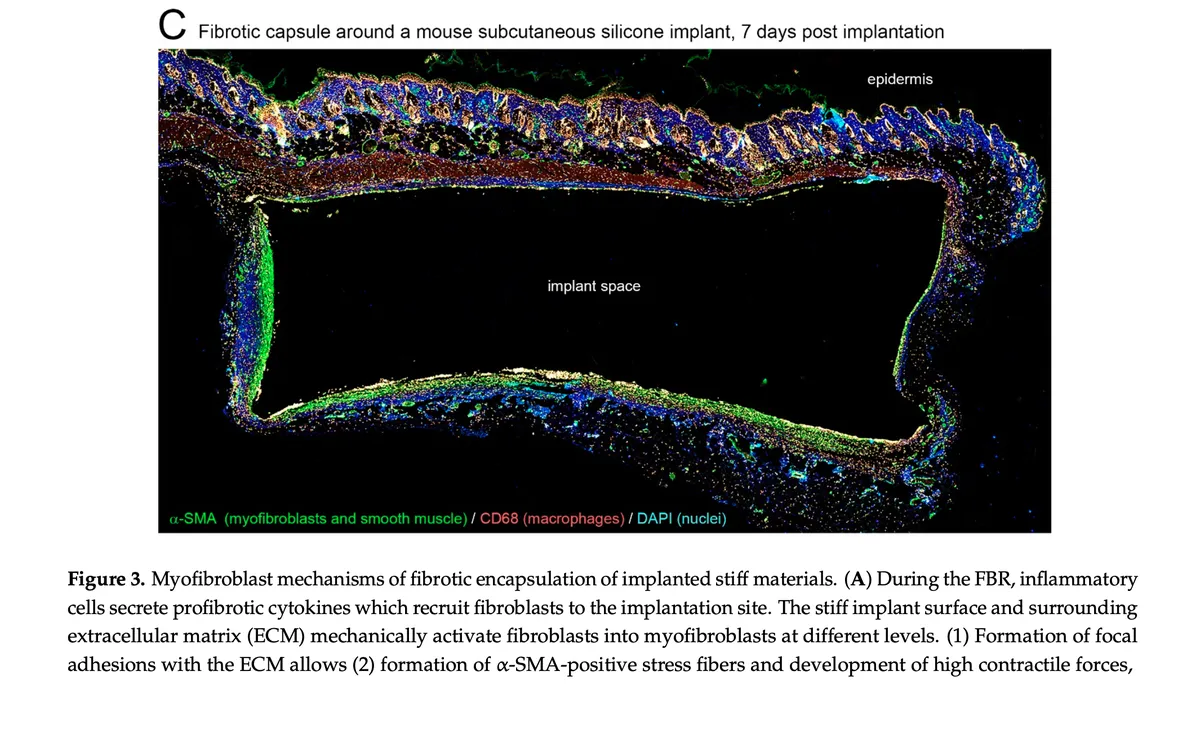 i-miofibroblasti-sono-1-buoni-o-2-cattivi