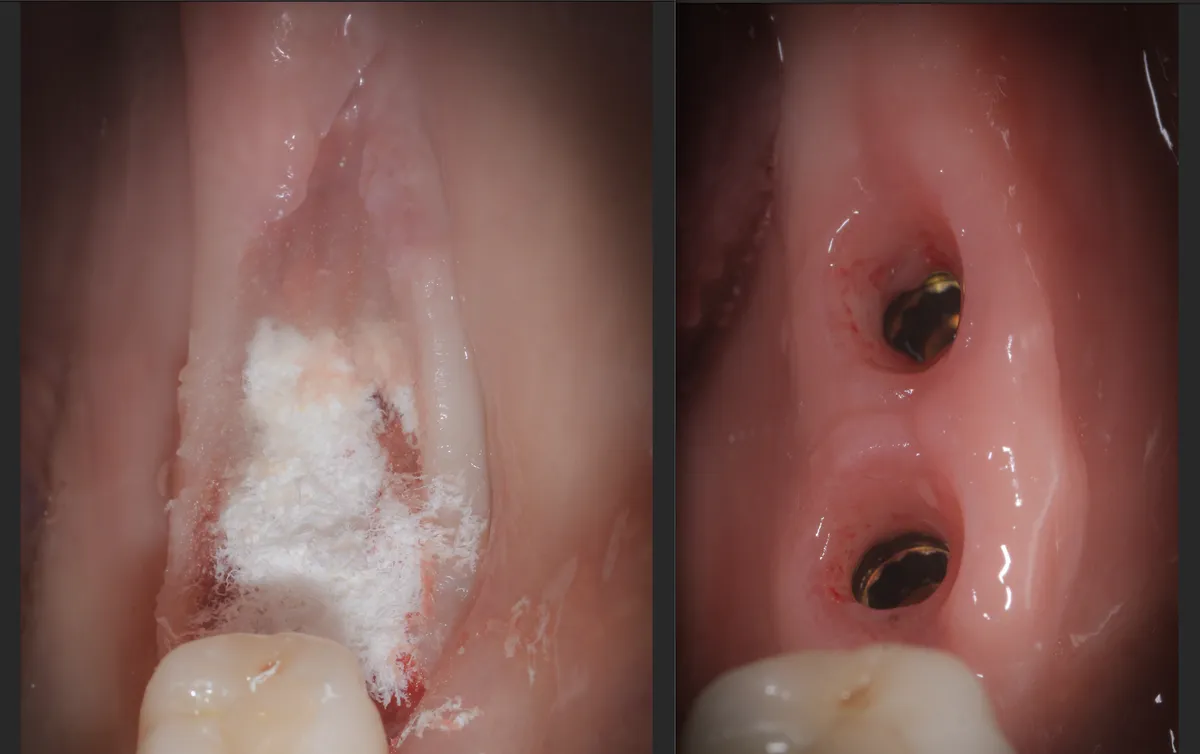 la-rivoluzionaria-scoperta-dellacqua-calda