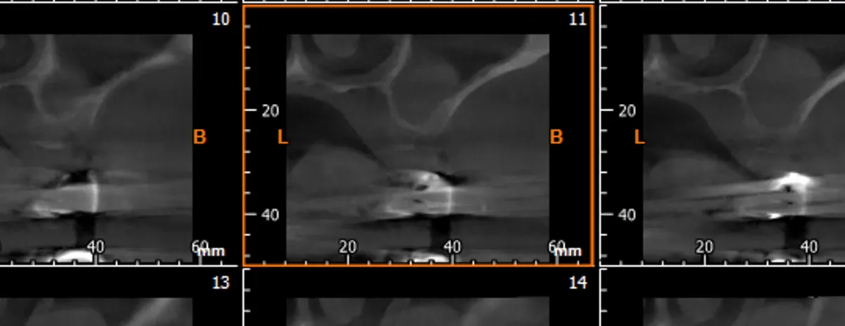 la-storia-di-francesco