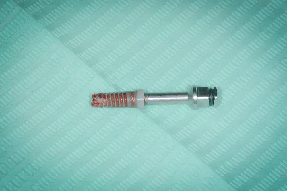 Rimozione di impianto incongruo