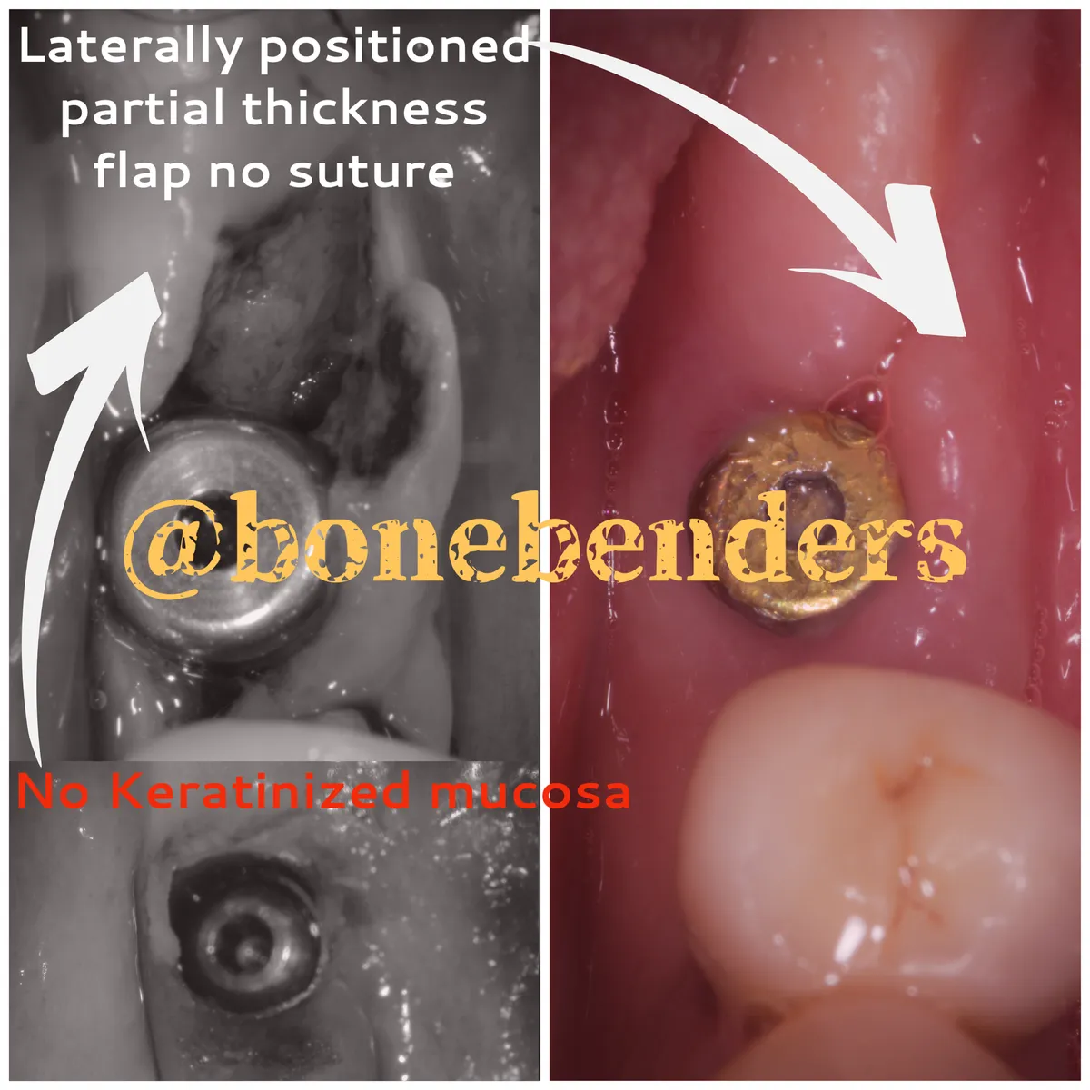 lemboriposizionatolaterale