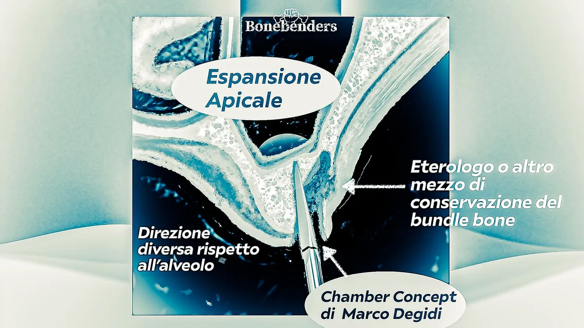 lillusione-della-semplicita-post-estrattivi-monoradicolati