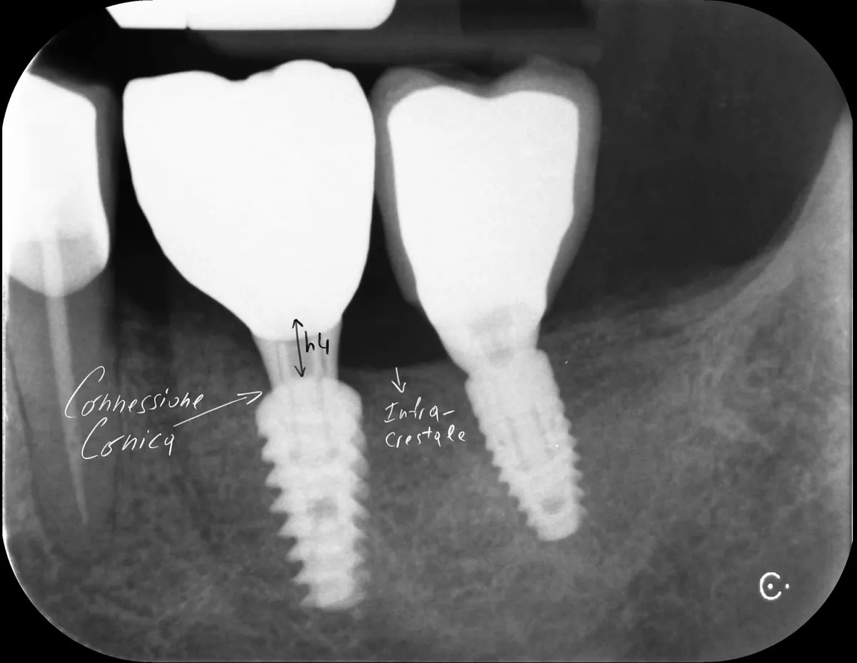 orrori-evitabili-impianti-connessioni-e-componenti