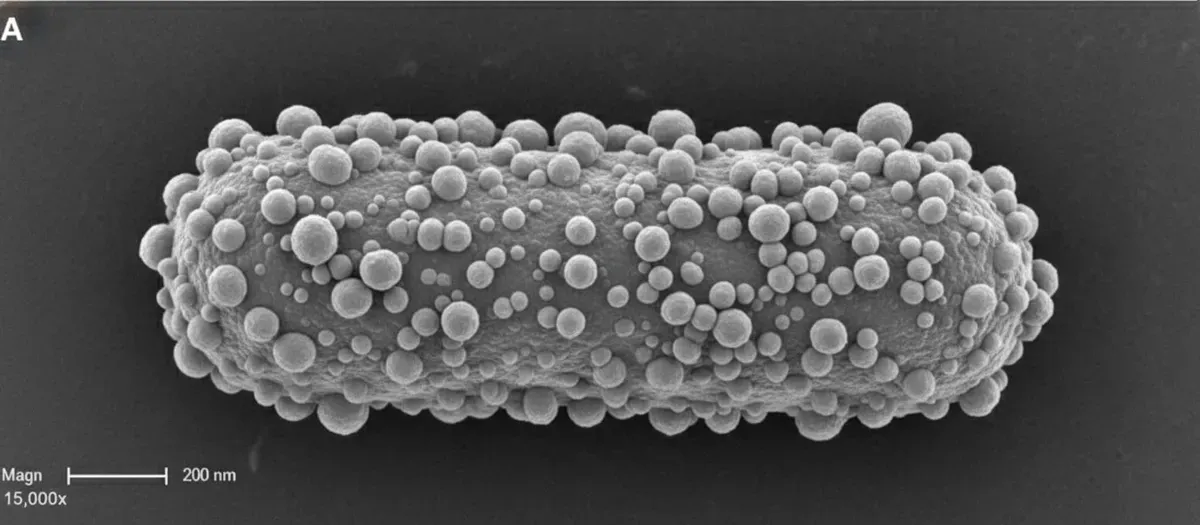 Parodontite e Alzheimer: Un Batterio Infetta il Cervello