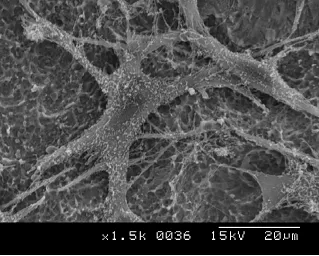 proteine-che-innescano-losteointegrazione-3-fasi