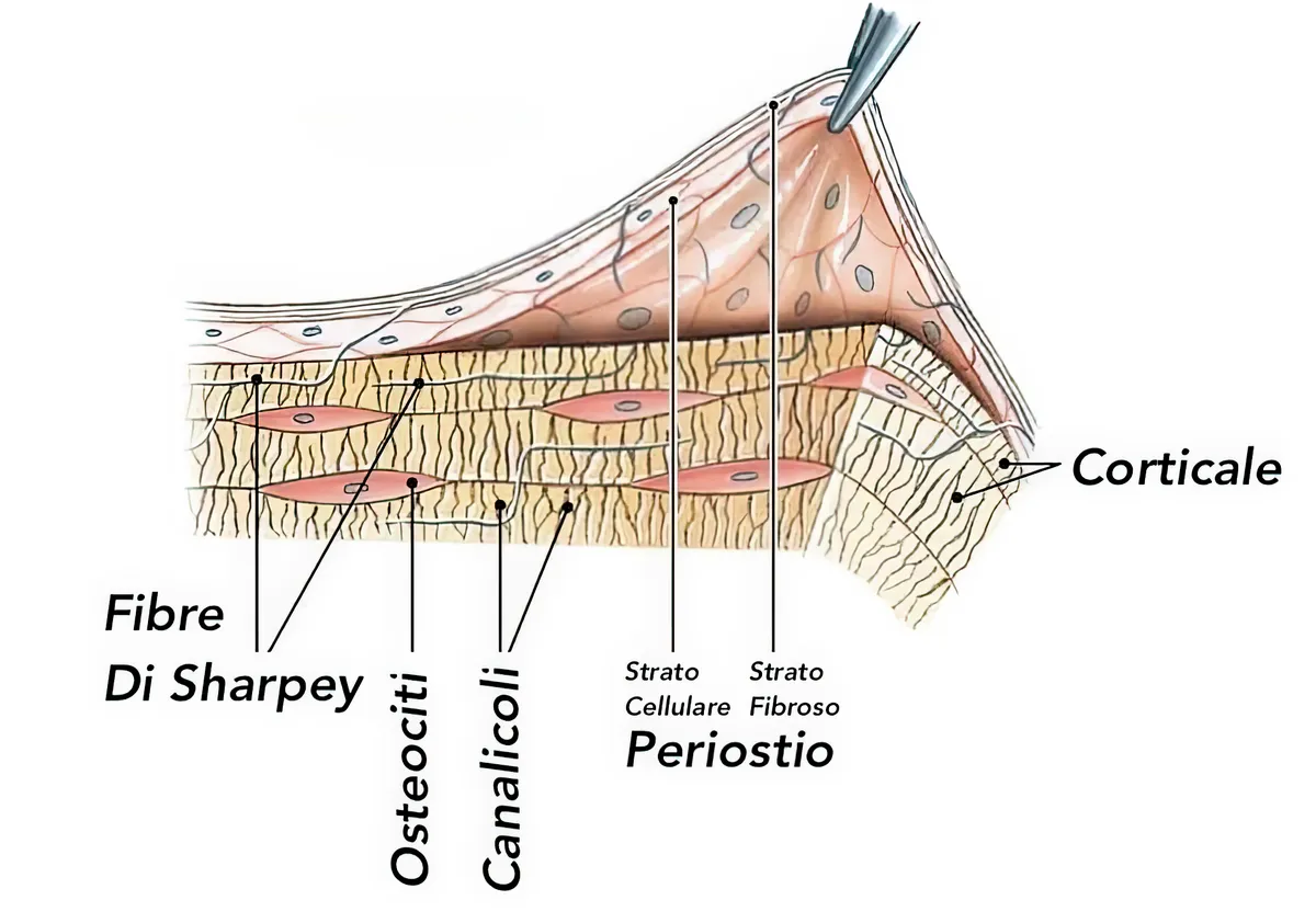 split-crest-serve-davvero-lo-spessore-parziale