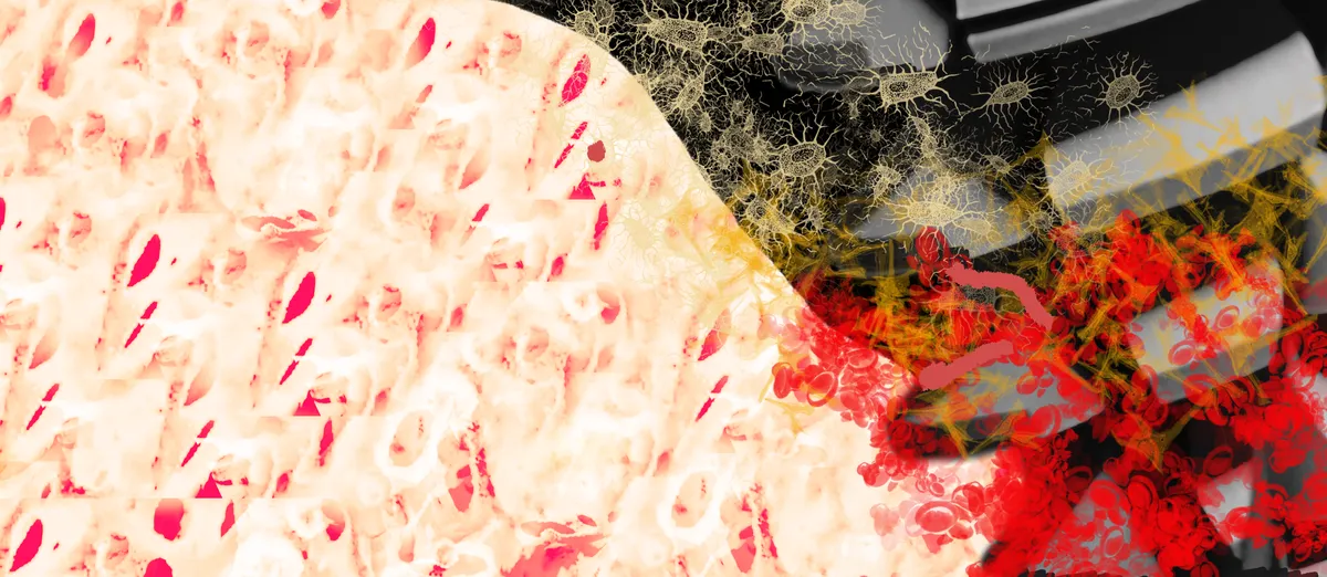 stabilita-primaria-impianti-mito-realta