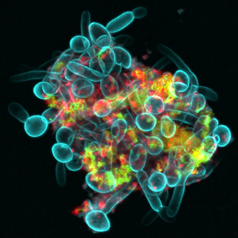 Microscopia confocale a fluorescenza di un cluster microbico orale nella saliva: Candida albicans (ciano), Streptococcus mutans (verde) e α-glucani (rosso). Immagine NIH/Zhi Ren, pubblico dominio.