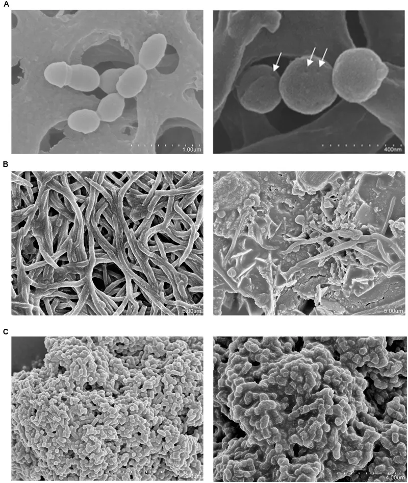 Microscopia elettronica a scansione (SEM) di tre patogeni orali prima e dopo il trattamento con il surnatante concentrato di S. dentisani. (A) S. mutans con pori visibili sulla membrana. (B) F. nucleatum. (C) P. intermedia. Fonte: López-López et al. 2017, Front Microbiol, CC-BY 4.0.