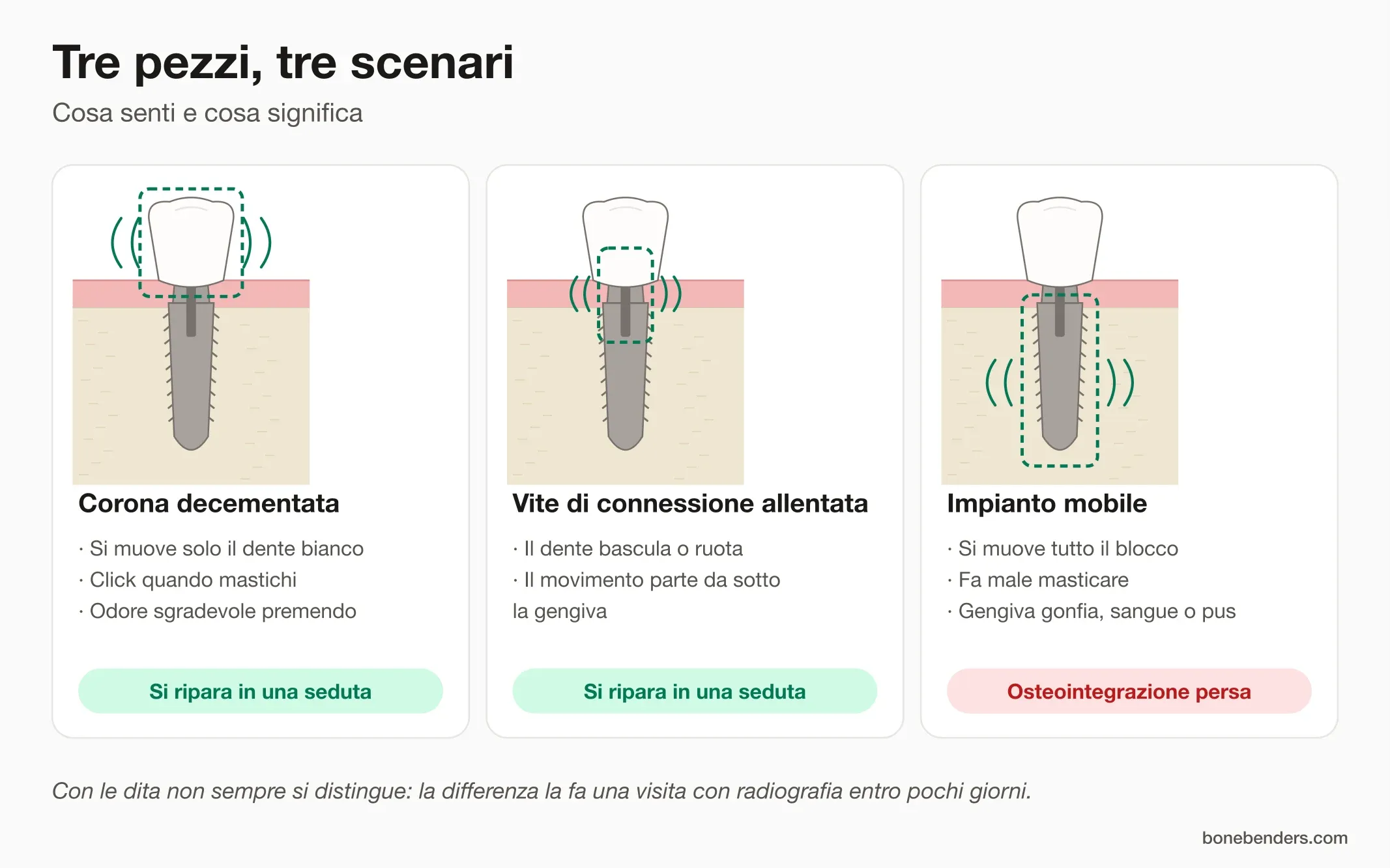 Infografica: tre scenari a confronto, corona decementata, vite di connessione allentata e impianto mobile, con i segni tipici e l'esito