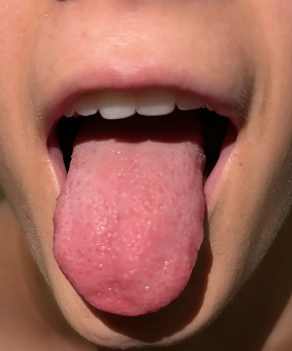 Immagine ravvicinata di una bocca aperta con la lingua rossa e umida protrusa.